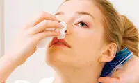 خون‌ریزی بینی در بارداری طبیعی است؟