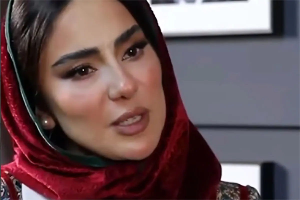بازیگر بامداد خمار: مجبور شدم کامپوزیت‌های دندانم را بردارم
