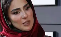 بازیگر بامداد خمار: مجبور شدم کامپوزیت‌های دندانم را بردارم