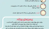 اینفوگرافی؛ مراقبت از پوست در برابر جوش و آکنه