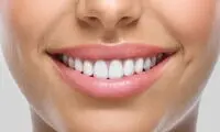 بررسی کامل انواع لمینت دندان + مزایا و معایب