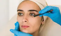 بلفاروپلاستی در کلینیک دکتر مهسا میرحاجی | جوانسازی و زیبایی ماندگار