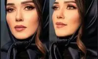 تغییر چهره شهرزاد کمال‌زاده در عکس جدیدش