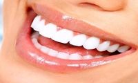 بهترین متخصص کامپوزیت دندان در تهران + لیست 10 تایی