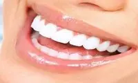 بهترین متخصص کامپوزیت دندان در تهران + لیست 10 تایی