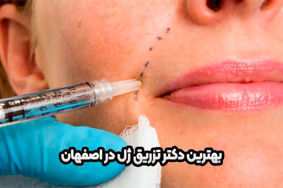 بهترین دکتر تزریق ژل در اصفهان کیست؟ معرفی 3 دکتر