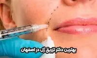 بهترین دکتر تزریق ژل در اصفهان کیست؟ معرفی 3 دکتر