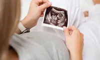 ماجرای عجیب بارداری نادر یک مادر آمریکایی