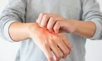 تاثیر میکروبیوم روده بر سلامت پوست