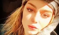 صورت تتو شده سحر قریشی پس از جدایی 