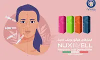زمان طلایی تزریق ژل قبل از مراسم عروسی