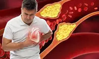 ۹ تغییر ساده برای بهبود چربی خون و مراقبت از قلب