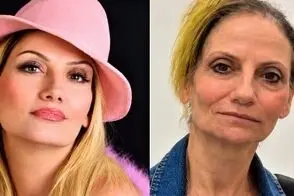 تصاویر باورنکردنی از پیر شدن ناگهانی هلن