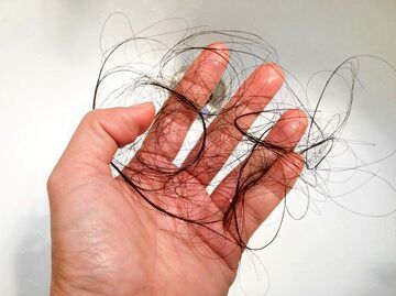 خانم‌ها بدانند؛ ۳ راه موثر برای جلوگیری از ریزش مو