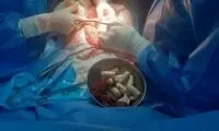 ۱۰۰ بسته مواد مخدر از بدن یک جوان ۲۲ ساله خارج شد