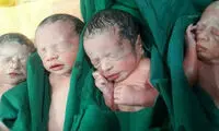 حمایت دولت از ۴قلو‌های کالپوشی