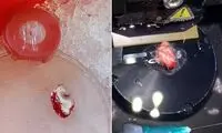 مغز انسان ۱۲ساعت در آزمایشگاه زنده ماند