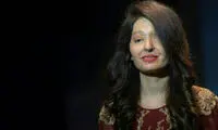 قربانی اسیدپاشی که مدل شد