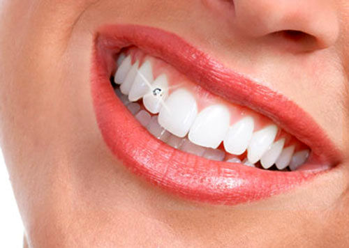 مدهای زیبایی چه بر سر دندان‌های‌تان می‌آورند؟