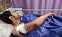زورگیری خونین از یک عکاس خبری در تهران