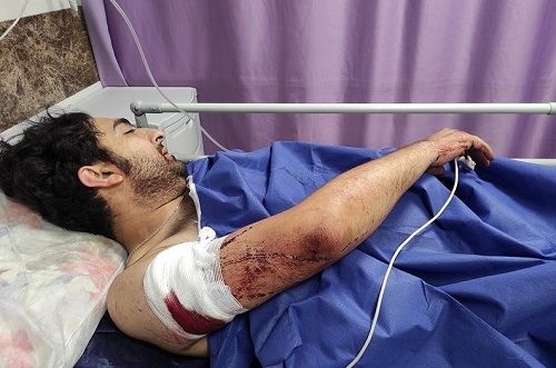 زورگیری خونین از یک عکاس خبری در تهران