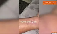 کنعانی‌زادگان: پایم ورم وحشتناکی کرده