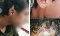 شکستن گوش به سبک یک مربی کشتی در نقده