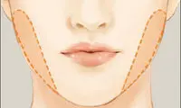 لیپوماتیک صورت چیست و هزینه آن چقدر است؟