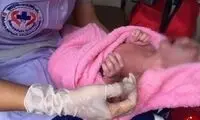 تولد نوزاد ۲۴ انگشتی در تایلند