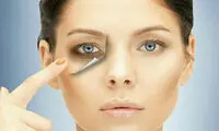 علت گودی و سیاهی زیر چشم چیست؟