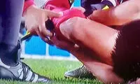 عکس: مصدومیت دلخراش بازیکن گوانگژو