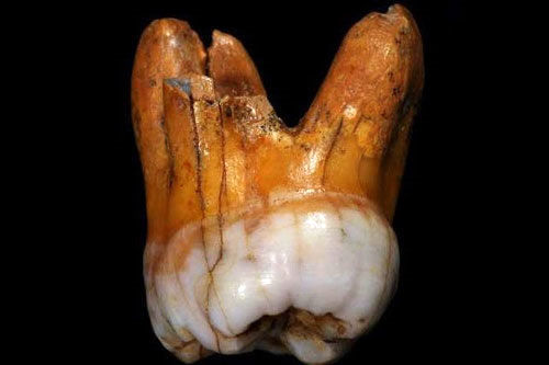 کشف دندان 110 هزار ساله در سیبری