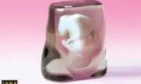 صاحب مجسمه 3 بعدی جنين خود شويد!