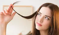 درباره شوره سر چه میدانید؟