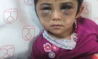 آزار کودک افغانستانی در خمینی شهر