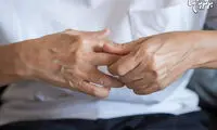 آرتروز چیست و چه علائمی دارد؟
