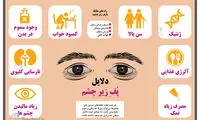 اینفوگرافی؛ دلایل پف زیر چشم