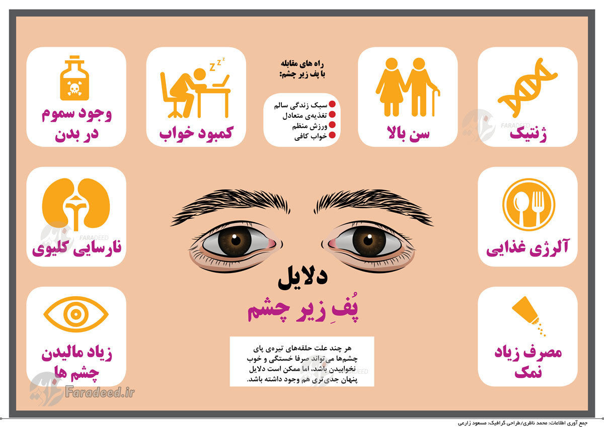 اینفوگرافی؛ دلایل پف زیر چشم