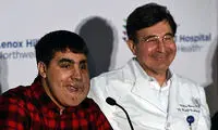 18 سال زندگی با زبان بیرون از دهان