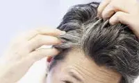 شناسایی ۶ وضعیت پزشکی از ظاهر موی سر