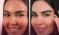 جدیدترین روش‌های کاشت ابرو طبیعی (2025) | مزایا، عوارض، ماندگاری