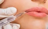 موج جدید کسانی که لب‌های اردکی را تخلیه می‌کنند تا «نچرال» شوند!
