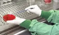  شناسایی نوعی باکتری گوشتخوار کشنده در این کشور