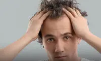 بهترین کلینیک کاشت مو در رشت + آدرس و تلفن