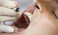 دلیل و درمان بوی بد دهان هنگام صبح