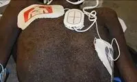 ساس‌ها یک زندانی را زنده زنده خوردند