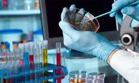 بهترین آزمایشگاه شمال تهران کجاست؟ + لیست  10 آزمایشگاه برتر
