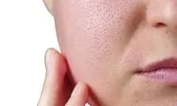 رازهایی که آینه درباره پوست صورت به شما نمی‌گوید! 