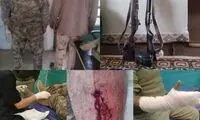 تصاویری از ضرب و شتم دو محیط‌بان لرستانی
