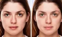 ویژگی‌های ظاهری که زنان را جوان‌تر از سن واقعی‌شان نشان می‌دهد